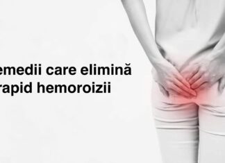 7 Remedii care elimină rapid hemoroizii