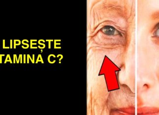 8 Semne că organismul tău are nevoie de mai multă vitamina C