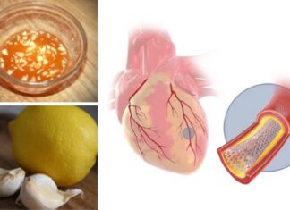 Combinatia genială care reduce nivelul colesterolului din sânge, stimulează circulația, scasde tensiunea și poate desfunda arterele infundate