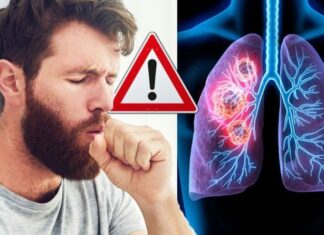 Avertisment privind cancerul pulmonar – dacă simțiți o durere atunci când tușiți, nu trebuie să o ignorați niciodată