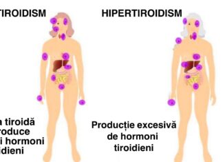 Milioane de femei ignoră simptomele afecțiunii tiroidiene până ce este prea târziu. Tu cunoști semnele acestei boli?