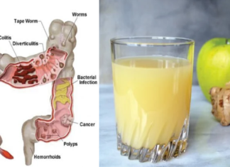 Combinați lămâia, mărul și ghimbirul în acest mod pentru a elimina kilogramele de toxine din organism și pentru a preveni problemele de sănătate cauzate de un colon toxic