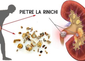 Rinichii tăi au nevoie de o curățare: Cum să-ți faci o curățare rapidă a rinichilor