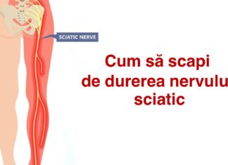 Cum să ameliorați durerea și amorțeala nervului sciatic?