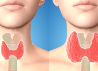Aveți probleme cu tiroida? Încercați aceste băuturi de detoxifiere pentru a elimina toxinele și pentru a stimula funcția tiroidiană