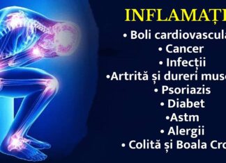 Cele mai bune alimente de consumat pentru a combate inflamația