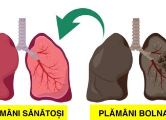 9 Plante care repară daunele pulmonare, luptă împotriva infecțiilor și îmbunătățesc sănătatea plămânilor