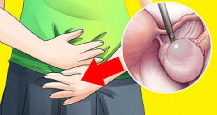 Early-Warning-Signs-Of-Ovarian-Cysts-Most-Women-Ignore-Every-Day-And-What-To-Do-If-You-See-Them.jpg.pagespeed.ce.QRigL4XaDB
