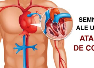 Corpul tău îți dă aceste 6 semne importante cu o lună înainte de un atac de cord – un lucru pe care toată lumea ar trebui să-l cunoască