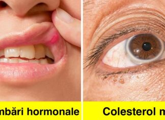 8 Semne de avertizare pe care ți le oferă corpul tău pe care nu ar trebui să le ignori