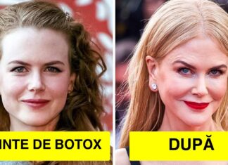 16 Vedete care au regretat că și-au făcut o procedură cosmetică. Cum arătau înainte și cum arată după