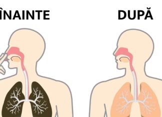 Cum să-ți detoxifiezi corpul în mod natural de nicotina acumulată