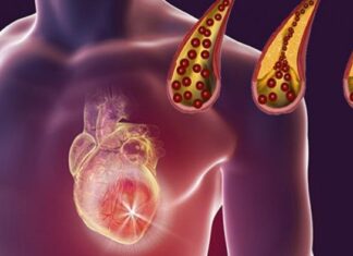 10 Alimente care vă mențin arterele curate și vă protejează de un atac de cord
