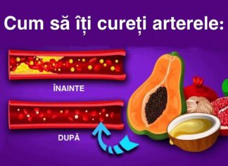 Lista cu cele mai bune 10 alimente care deblochează arterele în mod natural și previn atacul de cord