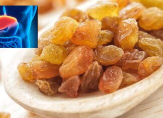 Stafidele – Cel mai sănătos fruct uscat. Reglează tensiunea arterială, curăță ficatul și rinichii, combat anemia, îți fac părul strălucitor și oferă multă energie organismului. Iată care este modul corect de consum al acestora: