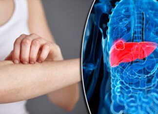 Ficatul este „motorul” organismului. Cum să înțelegeți că este plin de toxine și ce să faceți pentru a-l curăța de toate toxinele și de a-l face ca nou