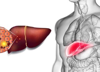 Combate inflamația ficatului și a pancreasului și fă-ți corpul să se simtă ca nou cu aceste 7 alimente