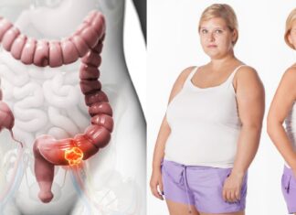 Superalimentul care echilibrează hormonii, te ajută să slăbești și te protejează de cancer!