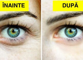 7 Moduri simple de a reduce ridurile în mod natural. Tenul tău va fi mai luminos, mai sănătos, mai tânăr, iar tu te vei simți mult mai încrezătoare în tine