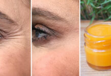 Mască de vitamina C cu efect botox: elimină ridurile în 2 minute