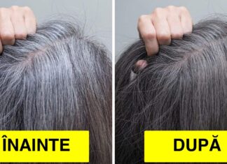10 Remedii care pot trata și preveni apariția părului gri