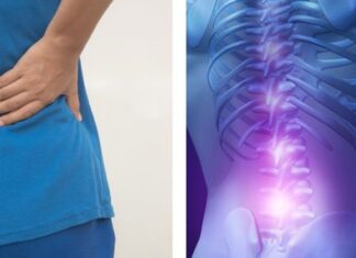 Cum să scăpați de durerea lombară și de cea a nervului sciatic rapid și eficient