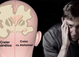 Scapă de stres și tratează boala Alzheimer, demența și depresia cu aceste 4 plante medicinale