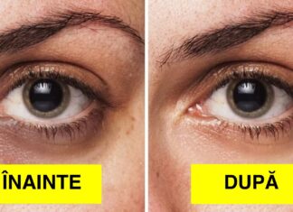 8 Modalități ieftine, dar 100% eficiente de a scăpa de cearcăne și de aspectul de piele lăsată și îmbătrânită și de a-ți face tenul să arate mai tânăr, mai luminos, mai sănătos și mai radiant în cel mai scurt timp